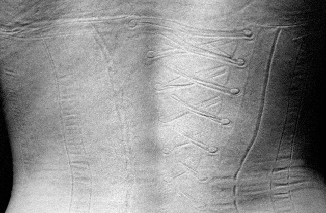 Les vêtements trop serrés… et leur effet sur le corps féminin