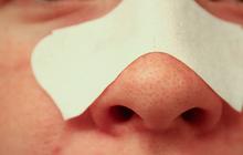Comment enlever les points noirs, éviter les pores dilatés…