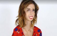 La « femme la plus moche du monde » explique comment elle a appris à s’aimer