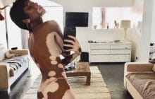 Winnie Harlow ou l’art de s’en battre l’utérus de l’avis des autres sur sa propre beauté !