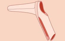 Le speculum réinventé par deux femmes fatiguées de souffrir