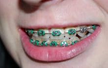 4 récits de premiers baisers, entre malaise et langue mouillée