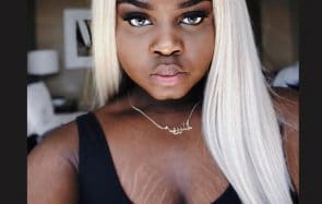 Elle répond aux questions sur ses vergetures et incite les gens à les assumer comme elle