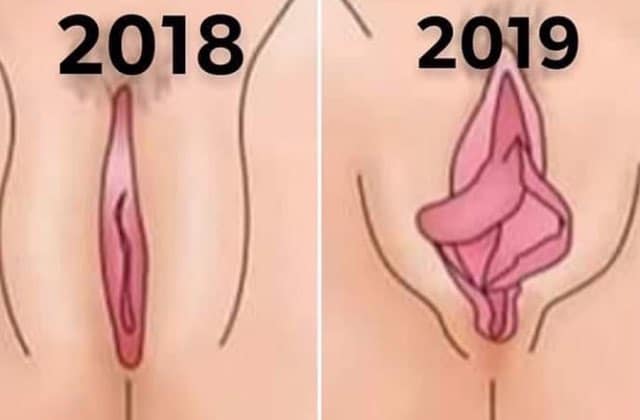 sexe-vagin-deforme.jpg