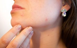 Comment savoir si ta peau est sèche, mixte ou grasse ?