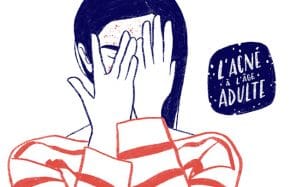 L’acné à l’âge adulte et ses conséquences sur l’estime de soi