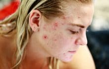 À quoi peut-on s’attendre quand on arrête la pilule ?